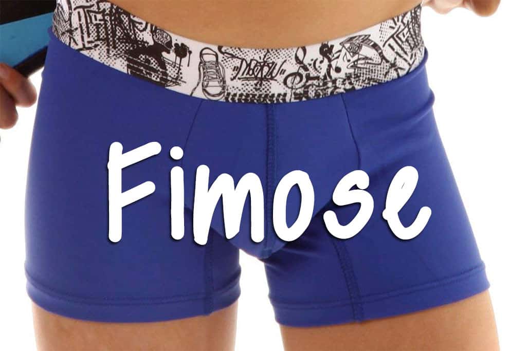 Fimose